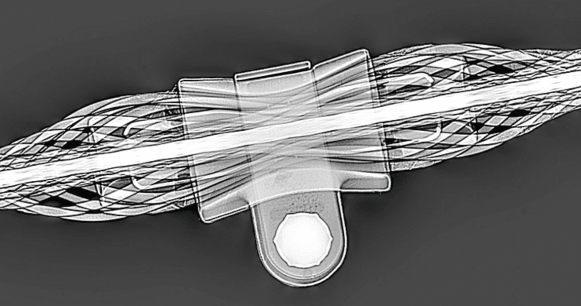 Новоскан ПО. Программное обеспечение для цифровой радиографии - 4