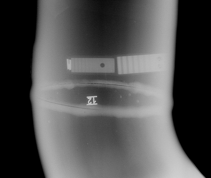 БеРКУТ 1012-120 цифровой радиографический программно-аппаратный комплекс - 2