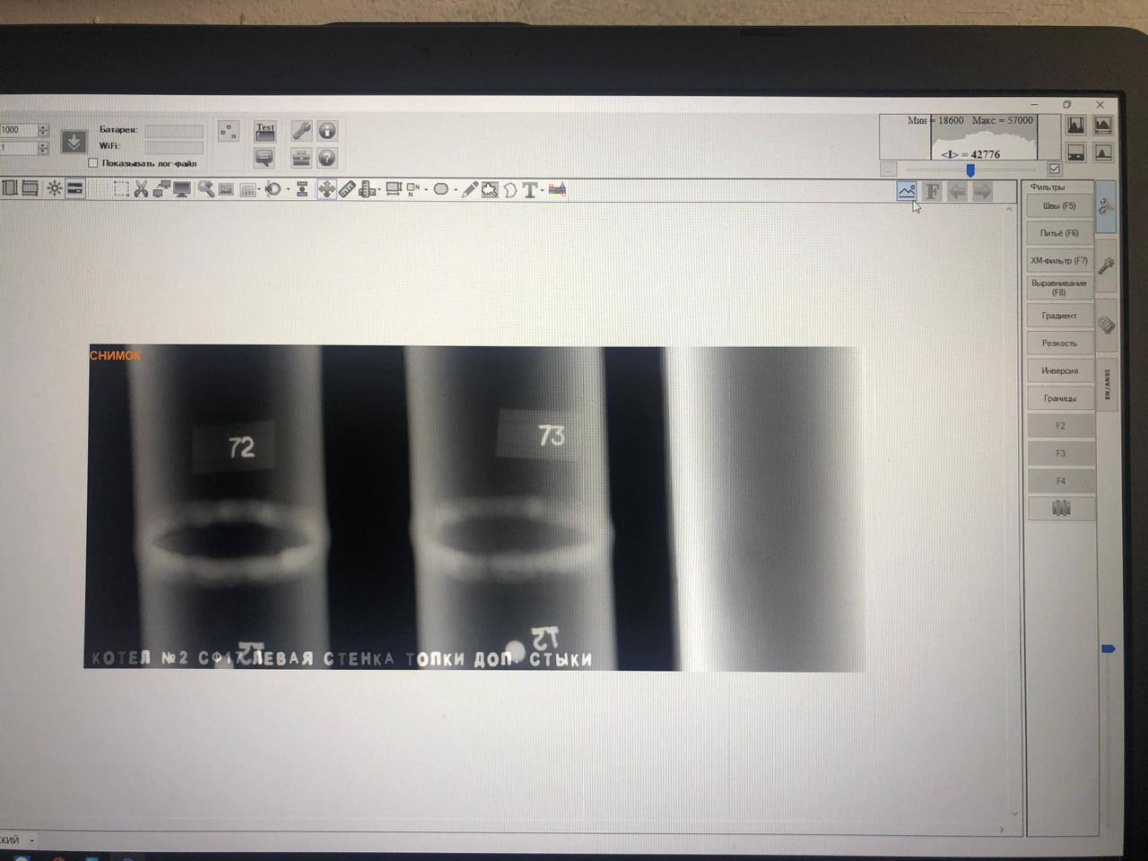 Карат РТС 1024 плоскопанельный рентгеновский детектор - 2