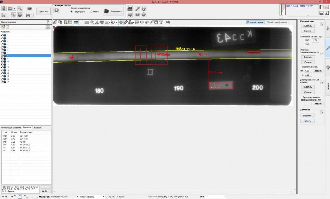 АПК КАРАТ РС35a оцифровщик рентгеновских плёнок - 2